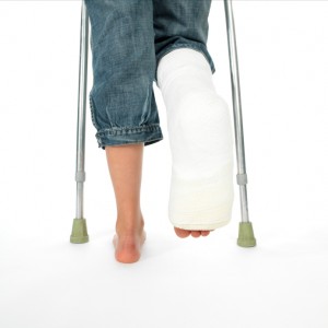 girl with a broken leg